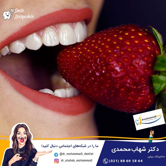 انواع مارک کامپوزیت دندان - کلینیک دندانپزشکی دکتر شهاب محمدی